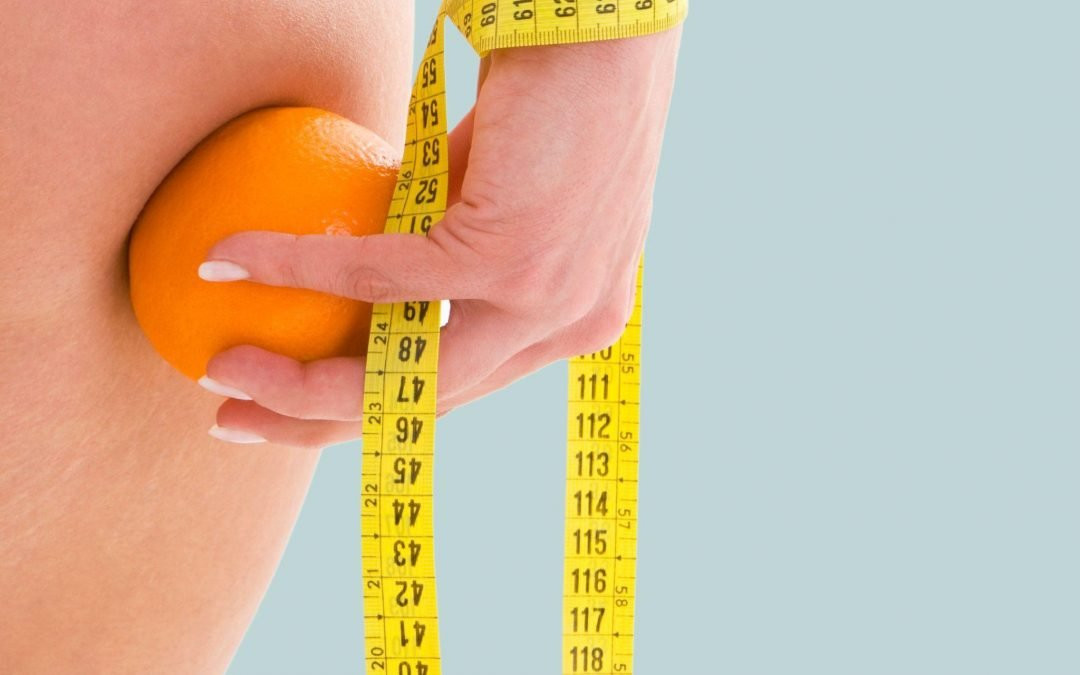 Los mejores tratamientos para combatir la celulitis
