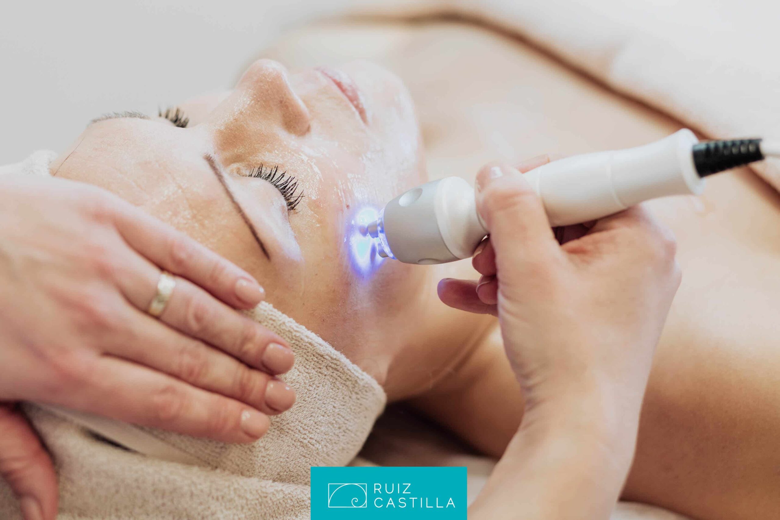 Comparativa entre tratamientos de rejuvenecimiento facial: láser vs radiofrecuencia vs peeling